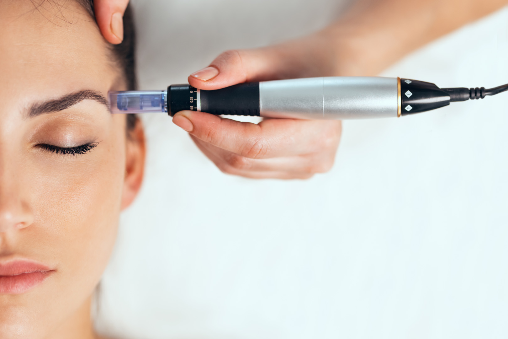 woman receiving a microneedling treatment