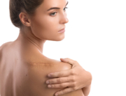 Woman with scar on her back